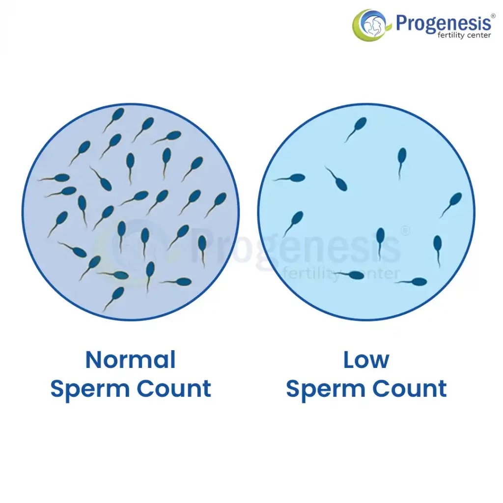 treat low sperm count